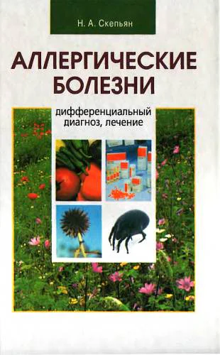 Аллергические болезни дифференциальный диагноз лечение