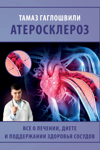 Атеросклероз Все о лечении диете и поддержании здоровья сосудов