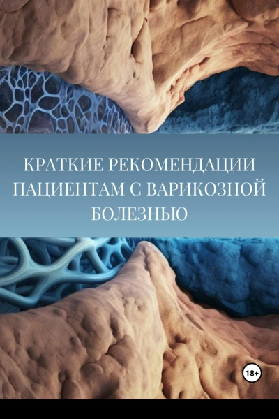 Краткие рекомендации пациентам с варикозной болезнью