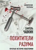 Похитители разума Краткая история лоботомии  СЧавкин